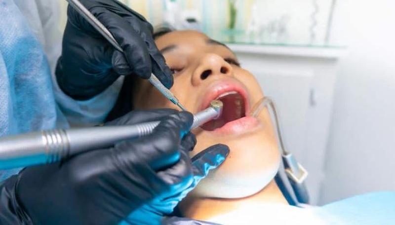 سيدة أمريكية تقاضي طبيب أسنان أجرى لها 32 عملية في جلسة واحدة